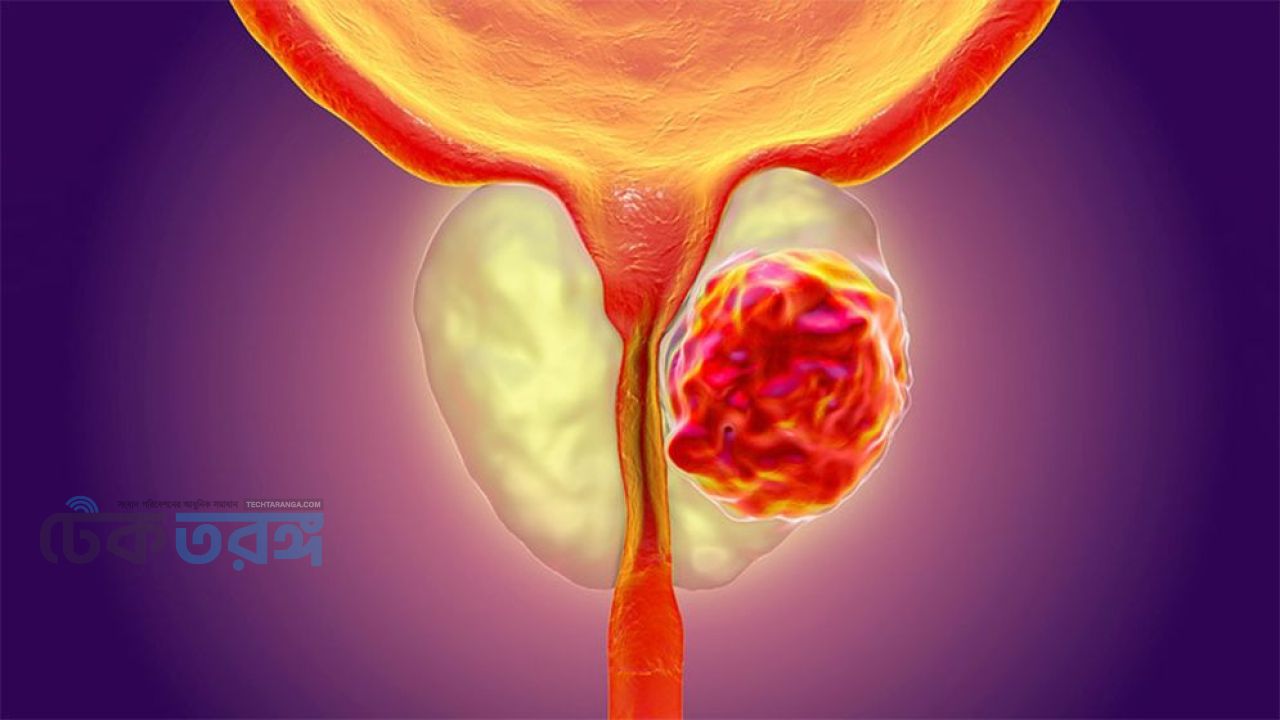 রক্তচাপ কেড়ে নিতে পারে দৃষ্টিশক্তি